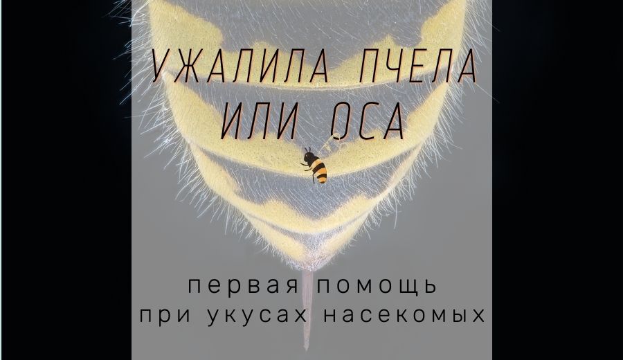 Что делать если ужалила пчела: первая помощь при укусах насекомых